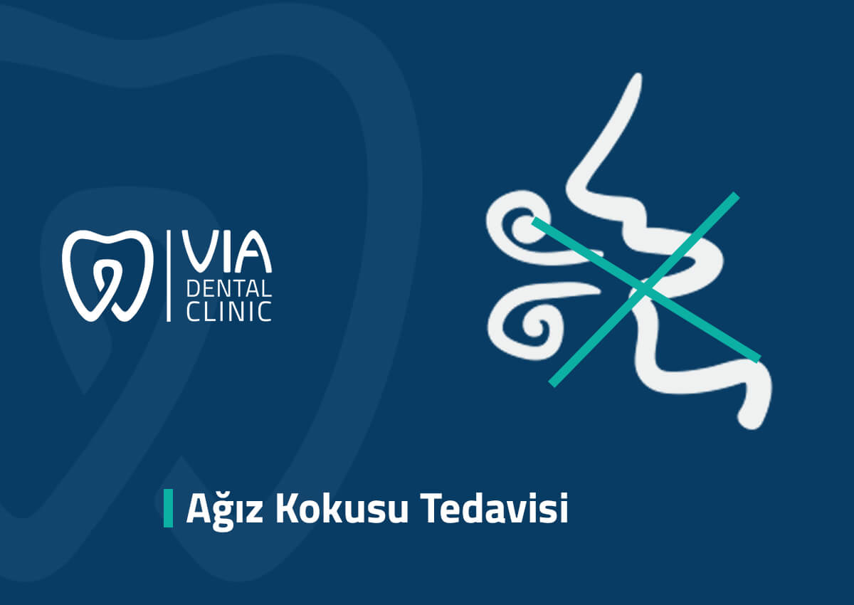 Ağız Kokusu Tedavisi